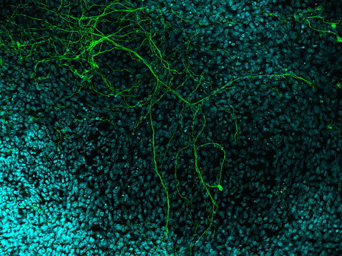 マウス胚葉体に誘導された神経系細胞
