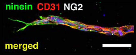 マウスES細胞由来Tip-cellにおけるNineinの発現
