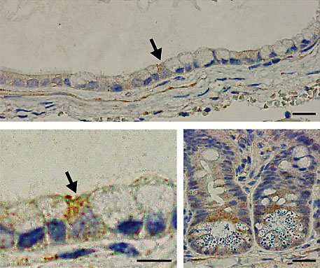 マウス腎皮膜下に構築されたES細胞由来腸管様構造とMusashi-1陽性腸管上皮幹細胞