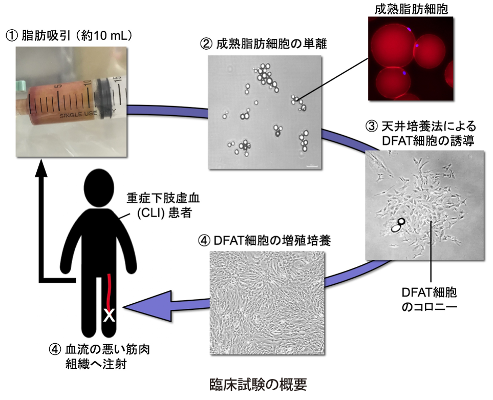 臨床試験の概要