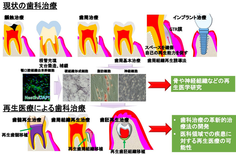 当科における再生医療の研究概要