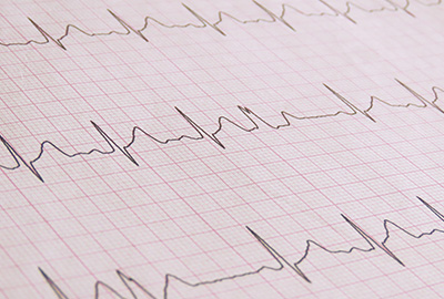 ほーかご心電図くらぶ部